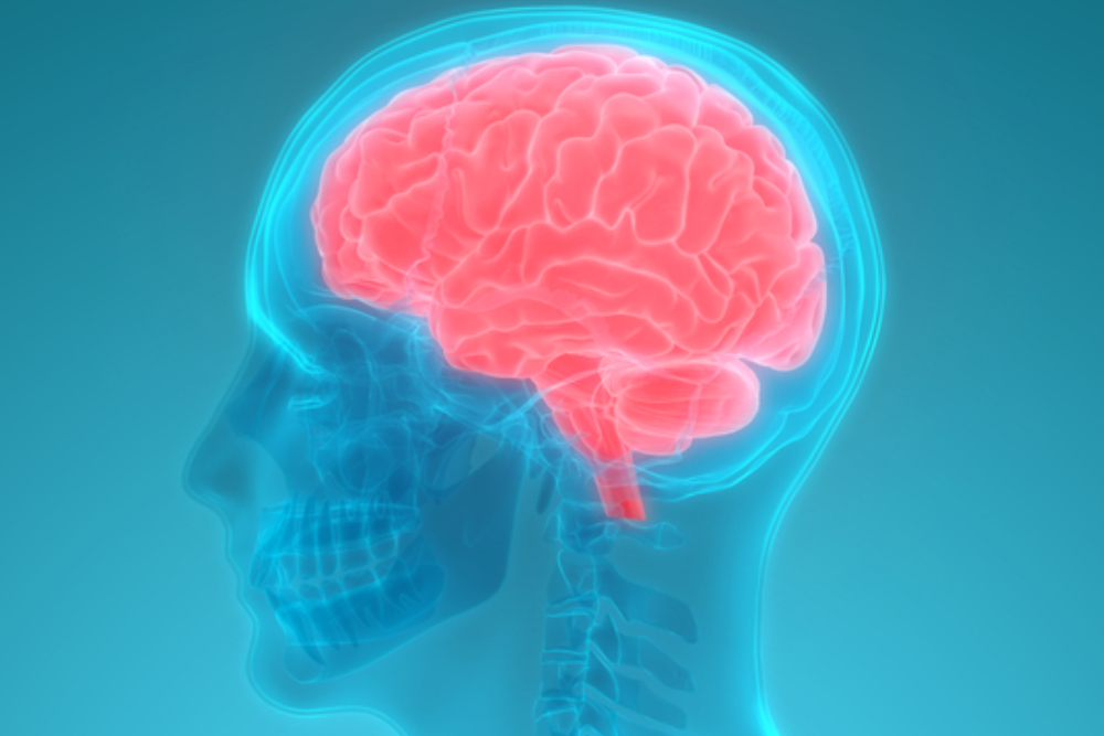 Glioblastoma cause, sintomi, cura e trattamento con Gamma Knife